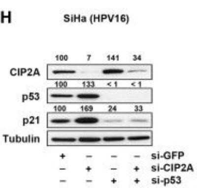 Western Blot: CIP2A Antibody (2G10) - Azide and BSA Free [NBP2-80670] - miR-375 increases p21, p53, and RB in HPV16- and 18-positive cancer. Protein levels of CIP2A, p53, and p21 in SiHa cells transfected with si-CIP2A and/or si-p53 were measured by Western blot analysis. Protein levels of CIP2A, p53, and p21 in SiHa cells transfected with si-p53 and/or miR-375-mimic were measured by Western blot analysis. Image collected and cropped by CiteAb from the following publication (//molecular-cancer.biomedcentral.com/articles/10.1186/1476-4598-13-80) licensed under a CC-BY license. Image from the standard format of this antibody.