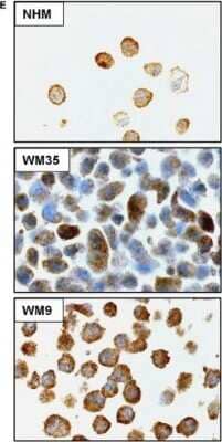 <b>Genetic Strategies Validation. </b>Immunohistochemistry: CIP2A Antibody [NB100-74663] - Characterization of CIP2A expression in a panel of normal human melanocytes (NHM) and melanoma cell lines. Cytoplasmic and nuclear expression of CIP2A in normal melanocytes, primary and metastatic melanoma cell lines assessed by immunohistochemical staining. CIP2A = cancerous inhibitor of protein phosphatase 2A. Image collected and cropped by CiteAb from the following publication (//doi.wiley.com/10.1002/cam4.425), licensed under a CC-BY license.