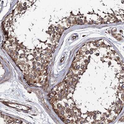 Immunohistochemistry-Paraffin: CIP2A Antibody [NBP2-48710] - Staining of human testis shows moderate cytoplasmic positivity in cells in seminiferous ducts.