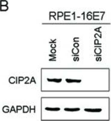 <b>Genetic Strategies Validation. </b>Knockdown Validated: CIP2A Antibody [NB100-68264] - Knockdown of CIP2A inhibited cell proliferation and DNA synthesis of HPV-16E7-expressing cells with CIP2A siRNA for 48 hr. Image collected and cropped by CiteAb from the following publication (oncotarget.com/fulltext/2867), licensed under a CC-BY license.