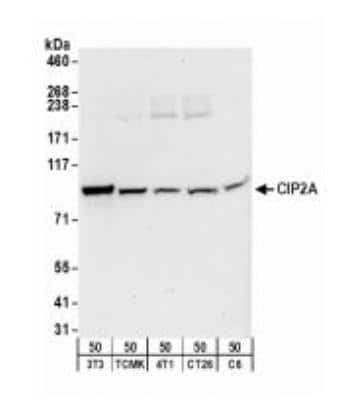 <b>Biological Strategies Validation. </b>Western Blot: CIP2A Antibody [NB100-68264] - Whole cell lysate (50 ug) from NIH3T3, TCMK-1, 4T1, CT26.WT, and rat C6 cells.