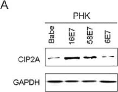 Western Blot: CIP2A Antibody [NB100-68264] - HPV-16E7 and -58E7 upregulated CIP2A mRNA and protein levels in PHKs(A) Western blot analysis of CIP2A protein level in PHKs expressing HPV-16E7, -58E7, -6E7. Image collected and cropped by CiteAb from the following publication (oncotarget.com/fulltext/2867), licensed under a CC-BY license.