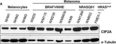 Western Blot: CIP2A Antibody [NB100-74663] - Characterization of CIP2A expression in a panel of normal human melanocytes (NHM) and melanoma cell lines. Immunoblot analysis of protein expression levels of CIP2A. Image collected and cropped by CiteAb from the following publication (//doi.wiley.com/10.1002/cam4.425), licensed under a CC-BY license.