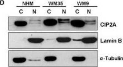 Western Blot: CIP2A Antibody [NB100-74663] - Characterization of CIP2A expression in a panel of normal human melanocytes (NHM) and melanoma cell lines. Cytoplasmic and nuclear expression of CIP2A in normal melanocytes, primary and metastatic melanoma cell lines assessed by immunoblot analysis. CIP2A = cancerous inhibitor of protein phosphatase 2A. Image collected and cropped by CiteAb from the following publication (//doi.wiley.com/10.1002/cam4.425), licensed under a CC-BY license.