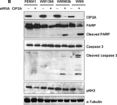 Western Blot: CIP2A Antibody [NB100-74663] - CIP2A downregulation reduces proliferation and induces apoptosis in melanoma cells. Immunoblot analysis showing reduction in cancerous inhibitor of protein phosphatase 2A protein levels 48 h post siRNA transfection and effects on proliferation and apoptosis markers. The figure is representative of at last three independent biological experiments. Image collected and cropped by CiteAb from the following publication (//doi.wiley.com/10.1002/cam4.425), licensed under a CC-BY license.