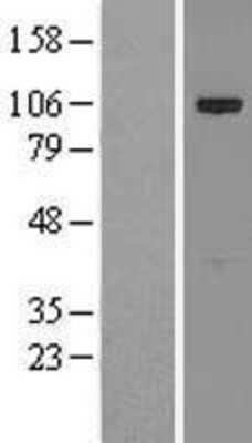 Western Blot: CIP2A Overexpression Lysate (Adult Normal) [NBL1-12266] Left-Empty vector transfected control cell lysate (HEK293 cell lysate); Right -Over-expression Lysate for CIP2A.