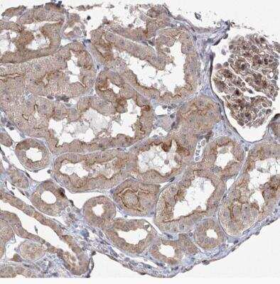 Immunohistochemistry-Paraffin CIPAR-1 Antibody