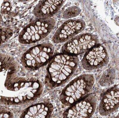 Immunohistochemistry-Paraffin CIPAR-1 Antibody