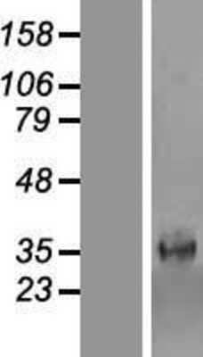 Western Blot: CIPAR-1 Overexpression Lysate (Adult Normal) [NBP2-07175] Left-Empty vector transfected control cell lysate (HEK293 cell lysate); Right -Over-expression Lysate for CIPAR-1.