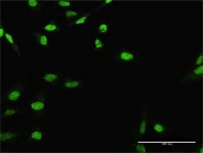 Immunocytochemistry/Immunofluorescence: CIRBP Antibody [H00001153-D01P] - Analysis of antibody to CIRBP on HeLa cell. Antibody concentration 20 ug/ml.