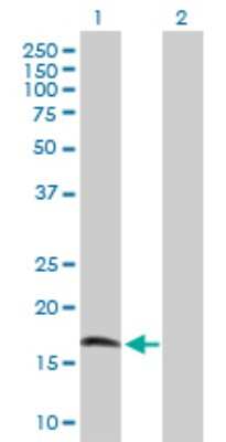 Western Blot: CIRBP Antibody [H00001153-D01P] - Analysis of CIRBP expression in transfected 293T cell line by CIRBP polyclonal antibody.Lane 1: CIRBP transfected lysate(18.60 KDa).Lane 2: Non-transfected lysate.