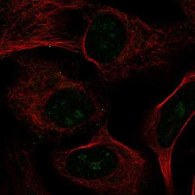 Immunocytochemistry/Immunofluorescence: CIRH1A Antibody [NBP2-58776] - Staining of human cell line U-2 OS shows localization to nucleoli fibrillar center.
