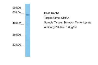 Western Blot: CIRH1A Antibody [NBP2-84687] - Host: Rabbit. Target Name: CIR1A. Sample Type: Stomach Tumor. Antibody Dilution: 1.0ug/ml