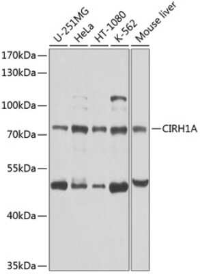 Western Blot: CIRH1A Antibody [NBP2-92565] - Analysis of extracts of various cell lines, using CIRH1A at 1:1000 dilution.Secondary antibody: HRP Goat Anti-Rabbit IgG (H+L) at 1:10000 dilution.Lysates/proteins: 25ug per lane.Blocking buffer: 3% nonfat dry milk in TBST.Detection: ECL Basic Kit .Exposure time: 5s.