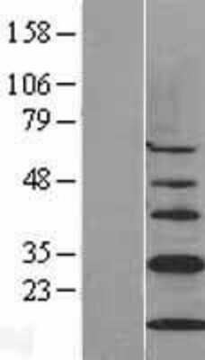 Western Blot: CISD1 Overexpression Lysate (Adult Normal) [NBL1-09214] Left-Empty vector transfected control cell lysate (HEK293 cell lysate); Right -Over-expression Lysate for CISD1.