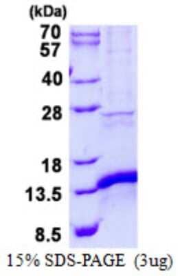 SDS-Page: CISD1 Protein [NBP2-22762]