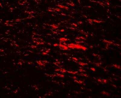 Immunocytochemistry/Immunofluorescence: CISD2 Antibody [NBP2-81907] - Analysis of CISD2 in rat brain tissue with CISD2 antibody at 20 ug/ml.