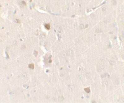 Immunohistochemistry: CISD2 Antibody [NBP2-81907] - Analysis of CISD2 in rat brain tissue with CISD2 antibody at 2.5 ug/ml.