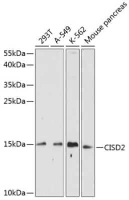 Western Blot: CISD2 Antibody [NBP2-92736] - Analysis of extracts of various cell lines, using CISD2 .Exposure time: 90s.