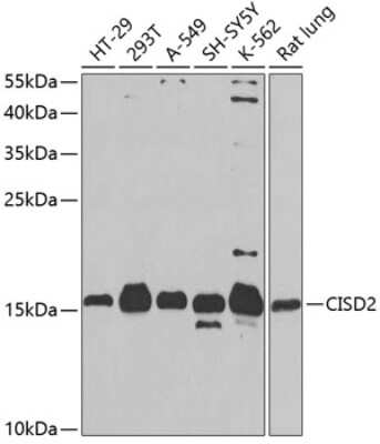 Western Blot: CISD2 Antibody [NBP2-92786] - Analysis of extracts of various cell lines, using CISD2 at 1:1000 dilution.Secondary antibody: HRP Goat Anti-Rabbit IgG (H+L) at 1:10000 dilution.Lysates/proteins: 25ug per lane.Blocking buffer: 3% nonfat dry milk in TBST.Detection: ECL Basic Kit .Exposure time: 90s.