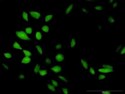Immunocytochemistry/Immunofluorescence: CISH/CIS-1 Antibody [H00001154-D01P] - Analysis of antibody to CISH on HeLa cell. Antibody concentration 10 ug/ml.