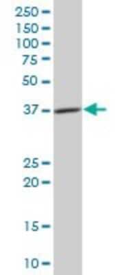 Western Blot: CISH/CIS-1 Antibody [H00001154-B01P] - Analysis of CISH expression in human spleen.