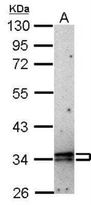 Western Blot: CISH/CIS-1 Antibody [NBP1-30943] - A: HeLa 10% SDS PAGE diluted at 1:10000