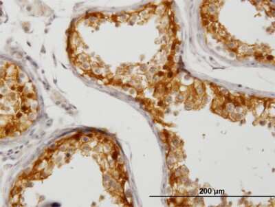 Immunohistochemistry-Paraffin: CITED1 Antibody (5H6) [H00004435-M03] - Analysis of monoclonal antibody to CITED1 on formalin-fixed paraffin-embedded human testis. Antibody concentration 1.2 ug/ml