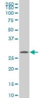 Western Blot: CITED1 Antibody (6E12) [H00004435-M04] - Analysis of CITED1 expression in A-431 (Cat # L015V1).
