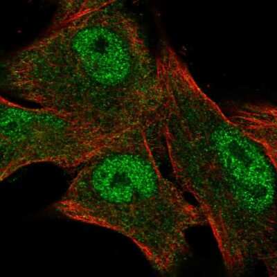 Immunocytochemistry/ Immunofluorescence CITED1 Antibody - BSA Free