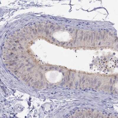 Immunohistochemistry-Paraffin CITED1 Antibody - BSA Free