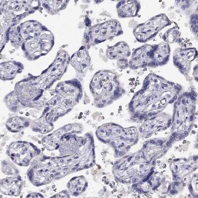 Immunohistochemistry-Paraffin CITED1 Antibody - BSA Free
