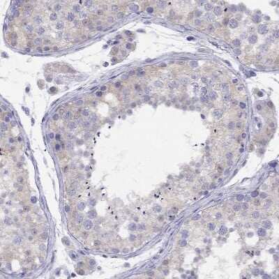 Immunohistochemistry-Paraffin CITED1 Antibody - BSA Free