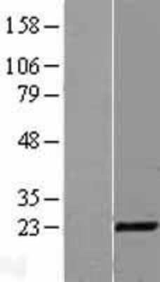 Western Blot CITED1 Overexpression Lysate