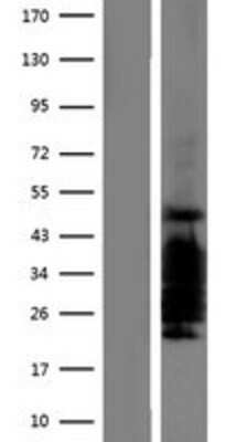 Western Blot: CITED2 Overexpression Lysate (Adult Normal) [NBP2-07668] Left-Empty vector transfected control cell lysate (HEK293 cell lysate); Right -Over-expression Lysate for CITED2.