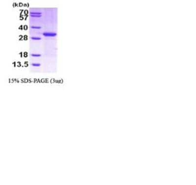 SDS-Page: CITED2 Protein [NBC1-28611] - CITED2, 29.5 kDa (278 aa), confirmed by MALDI-TOF with a purity of 90% by SDS - PAGE