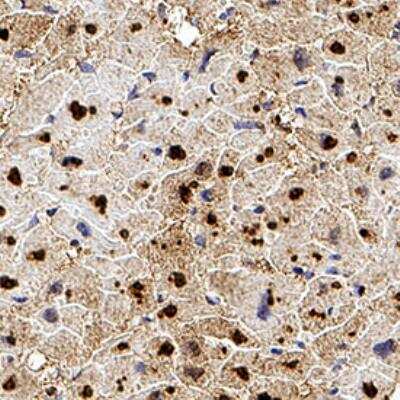 Immunohistochemistry-Paraffin: CITED4 Antibody (HT13-2D6.3) [NB110-41572] - CITED4 was detected in immersion fixed paraffin-embedded sections of human heart using Mouse Anti-Human CITED4 (HT13-2D6.3) Monoclonal Antibody (Catalog # NB110-41572) at 1:300 for 1 hour at room temperature followed by incubation with the Anti-Mouse IgG VisUCyte™ HRP Polymer Antibody (Catalog # VC001). Tissue was stained using DAB (brown) and counterstained with hematoxylin (blue). Specific staining was localized to the cytoplasm in cardiomyocytes.