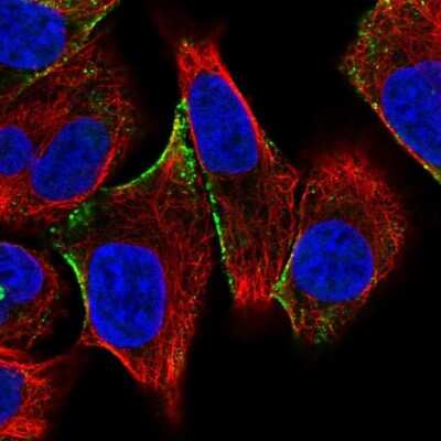 Immunocytochemistry/Immunofluorescence: CITED4 Antibody [NBP2-33788] - Immunofluorescent staining of human cell line A549 shows localization to vesicles.