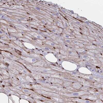 Immunohistochemistry-Paraffin: CITED4 Antibody [NBP2-33788] - Staining of human heart muscle shows moderate membranous positivity in myocytes.