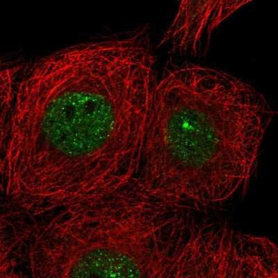 Immunocytochemistry/Immunofluorescence: CIZ1 Antibody [NBP2-33890] - Staining of human cell line MCF7 shows localization to nucleoplasm.