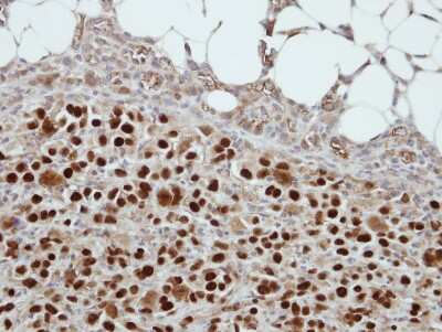 Immunohistochemistry-Paraffin: CIZ1 Antibody [NBP2-15906] - Immunohistochemical analysis of paraffin-embedded ES2 xenograft, using antibody at 1:500 dilution.