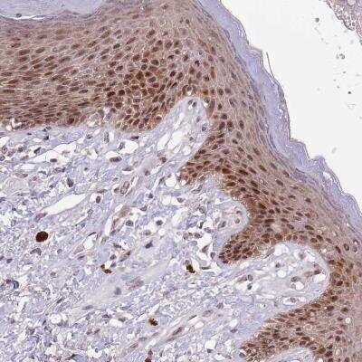 Immunohistochemistry-Paraffin: CIZ1 Antibody [NBP2-33890] - Staining of human vulva/anal skin shows strong nuclear positivity in epidermal cells.