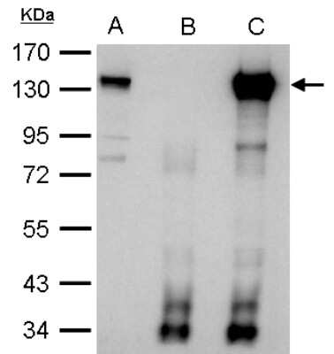 Immunoprecipitation: CIZ1 Antibody [NBP2-15906] - CIZ1 antibody immunoprecipitates CIZ1 protein in IP experiments. IP Sample: 1000 ug HeLa whole cell lysate/extract A. 40 ug HeLa whole cell lysate/extract B. Control with 2. 5 ug of preimmune rabbit IgG C. Immunoprecipitation of CIZ1 protein by 2. 5 ug of CIZ1 antibody 7. 5% SDS-PAGE The immunoprecipitated CIZ1 protein was detected by CIZ1 antibody diluted at 1:1000. Anti-rabbit IgG was used as a secondary reagent.