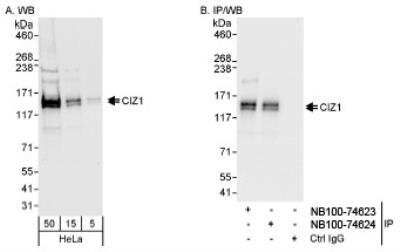 Western Blot: CIZ1 Antibody [NB100-74623] - Detection of Human CIZ1 on HeLa whole cell lysate. CIZ1 was also  immunoprecipitated by rabbit anti-CIZ1 antibody NB100-74624.