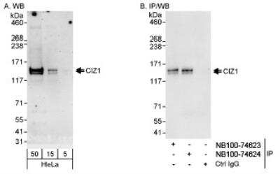 Western Blot CIZ1 Antibody