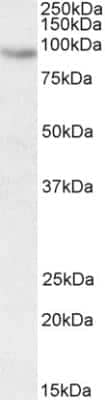 Western Blot: CIZ1 Antibody [NBP2-26207] - Staining of HeLa nuclear lysate (35 ug protein in RIPA buffer). Primary incubation was 1 hour. Detected by chemiluminescence.  