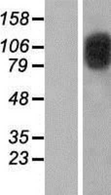 Western Blot CIZ1 Overexpression Lysate