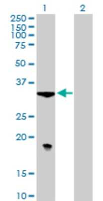 Western Blot: CKAP1 Antibody [H00001155-B01P] - Analysis of TBCB expression in transfected 293T cell line by TBCB polyclonal antibody.  Lane 1: CKAP1 transfected lysate(26.84 KDa). Lane 2: Non-transfected lysate.