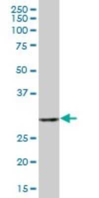 Western Blot: CKAP1 Antibody [H00001155-B02P] - Analysis of CKAP1 expression in human spleen.