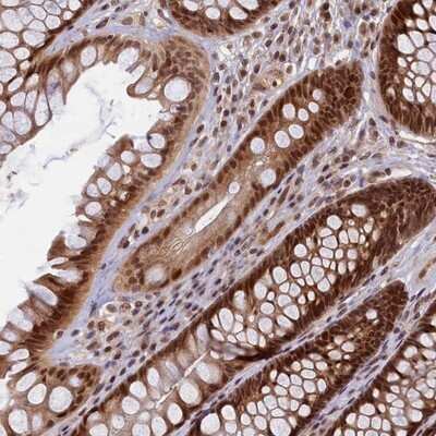 Immunohistochemistry-Paraffin: CKAP2L Antibody [NBP1-83450] - Staining of human rectum shows strong cytoplasmic and nuclear positivity in glandular cells.